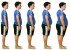 Problemas de salud por causa de la obesidad