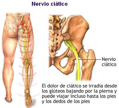 Nervio Ciático